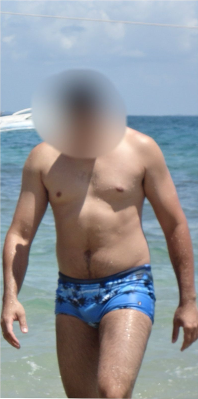 Antes